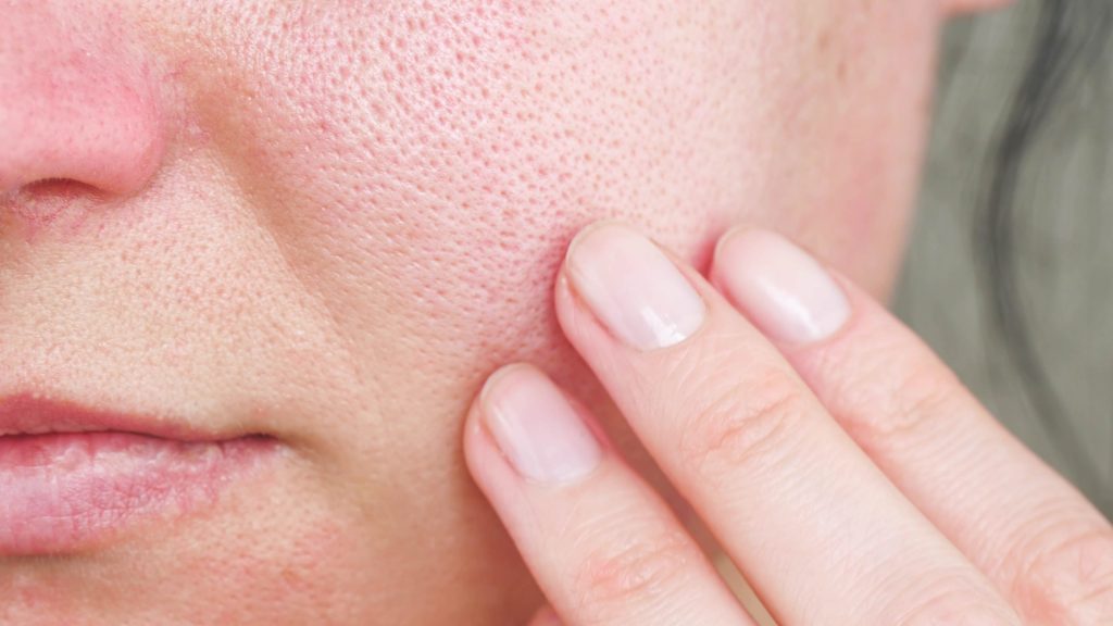 Redelijk Het is goedkoop gemeenschap 8 Tips Om Poriën Te Verkleinen | Mineral Skin Cosmetics